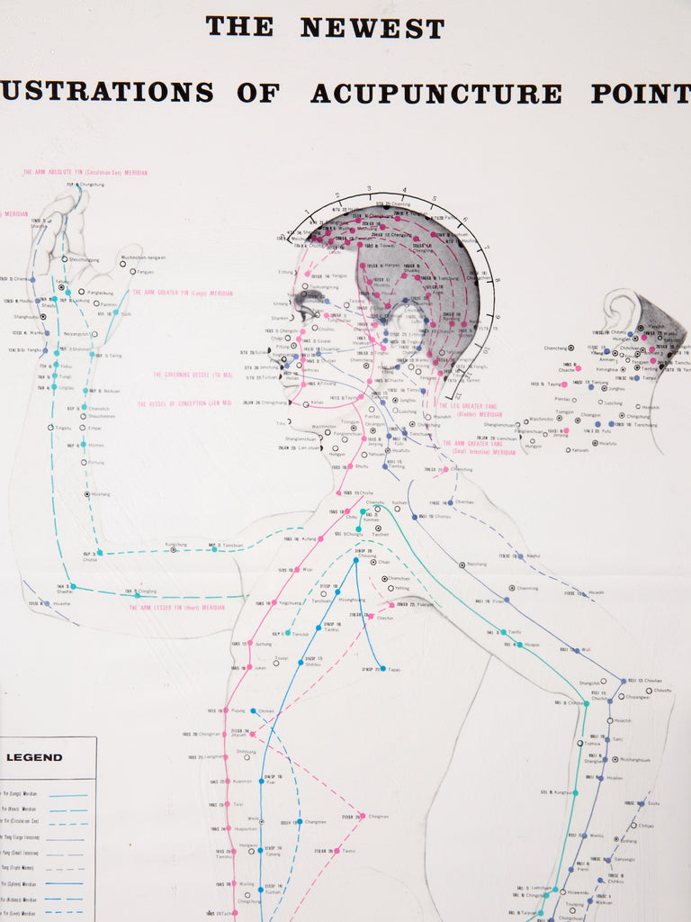 Framed Acupuncture Charts