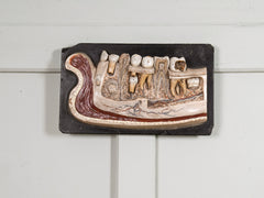 A 19th Century Plaster Didactic Model of Malformed Teeth