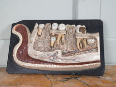 A 19th Century Plaster Didactic Model of Malformed Teeth