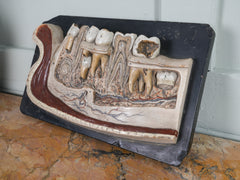 A 19th Century Plaster Didactic Model of Malformed Teeth