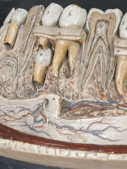 A 19th Century Plaster Didactic Model of Malformed Teeth