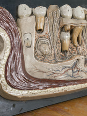 A 19th Century Plaster Didactic Model of Malformed Teeth